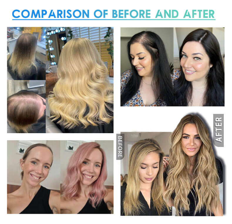 Chic Hair Topper for Women